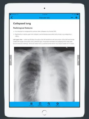 CXR FlashCards - Reference app for Chest X-rays android App screenshot 0