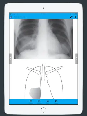 CXR FlashCards - Reference app for Chest X-rays android App screenshot 1