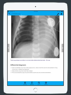 CXR FlashCards - Reference app for Chest X-rays android App screenshot 2