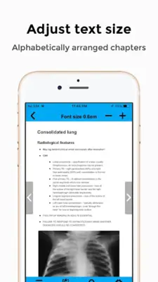 CXR FlashCards - Reference app for Chest X-rays android App screenshot 4