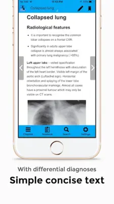 CXR FlashCards - Reference app for Chest X-rays android App screenshot 6