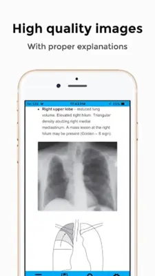 CXR FlashCards - Reference app for Chest X-rays android App screenshot 7